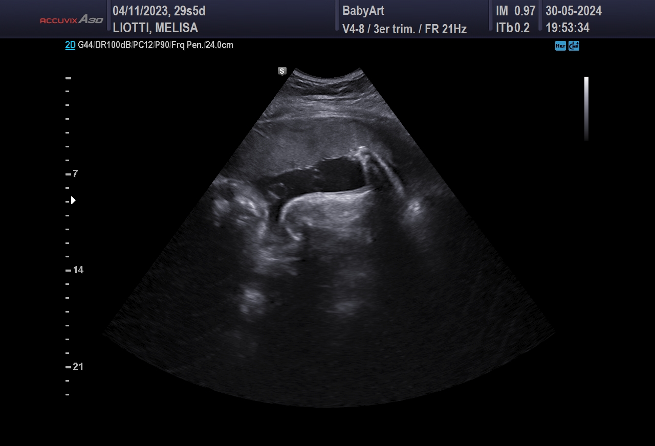 JULIA DE MELISA LIOTTI_0029.JPG